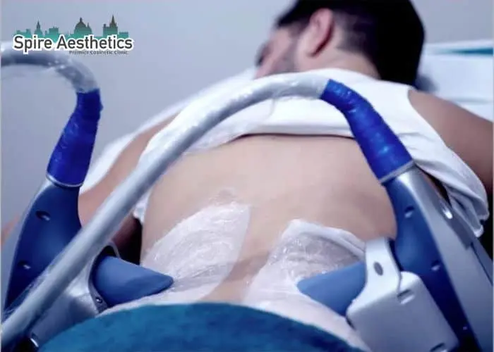Man having fat freezing treatment done on love handles before a competitions Grays to create a sculpted look.